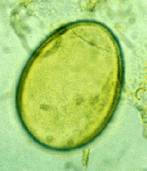 Diphyllobothrium Latum Egg Diphyllobothrium Latum Egg
