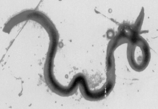Angiostrongylus Cantonensis Angiostrongylus Cantonensis