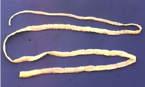 Fish Tapeworm Fish Tapeworm