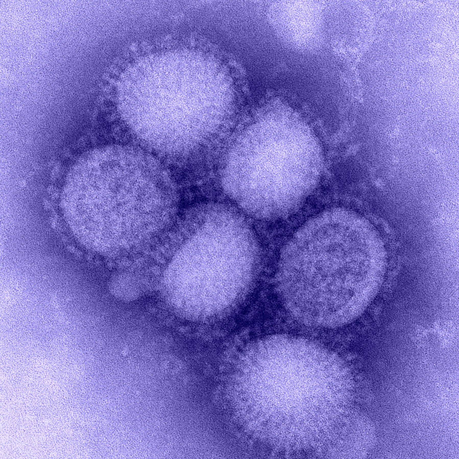 Hình phóng đại (2) virus H1N1 Hình phóng đại (2) virus H1N1