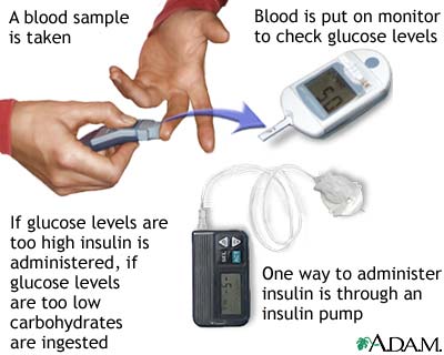 Glucose Test Glucose Test