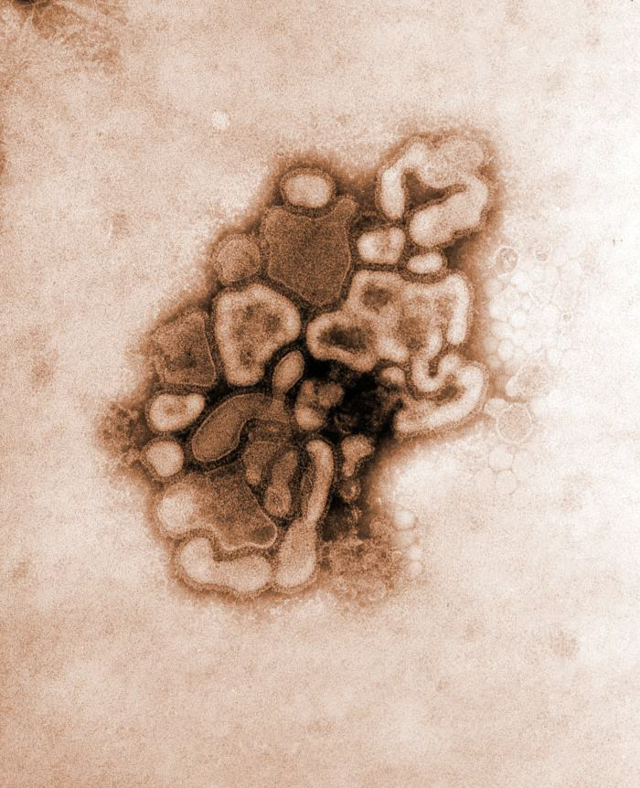 Hình phóng đại virus H1N1 Hình phóng đại virus H1N1